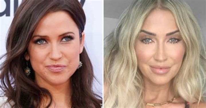 Did Kaitlyn Bristowe Have Plastic Surgery? Here’s Everything She Has Done to Stay Looking Great