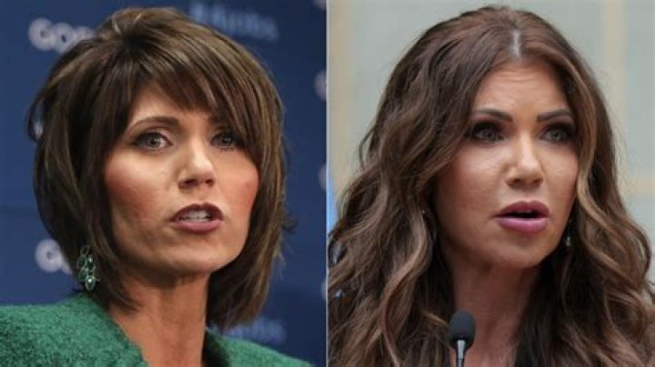 Did Rachel Uchitel Have Plastic Surgery? Where Is She Now?