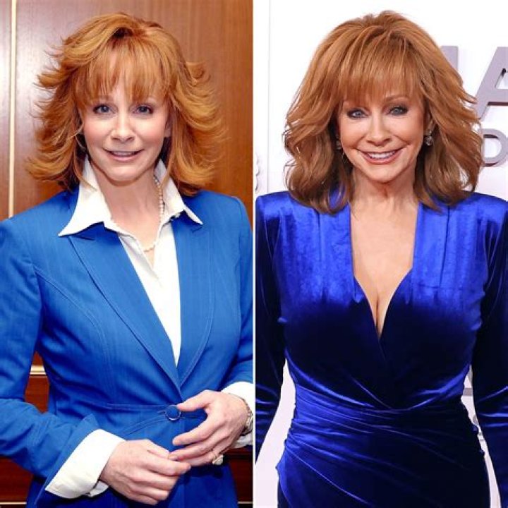 Has Reba McEntire Had Plastic Surgery? She Says No, the Internet Says Yes