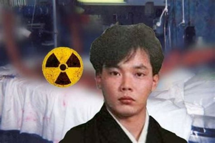 Hisashi Ouchi: A Haunting Reminder Of The Horrors Of Radiation