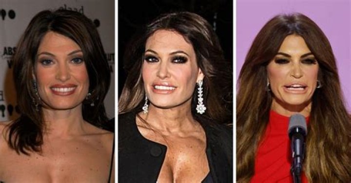 Kimberly Guilfoyle Face: Uncovering Her Unique Features