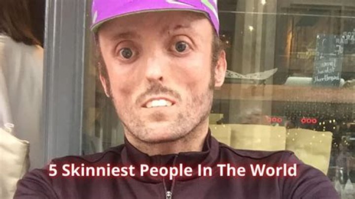 Meet The Incredibly Thin "World's Skinniest Person"