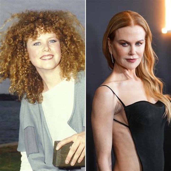 Nicole Kidman's Not-So-Secret Surgery: The Truth About Her Fake Boobs