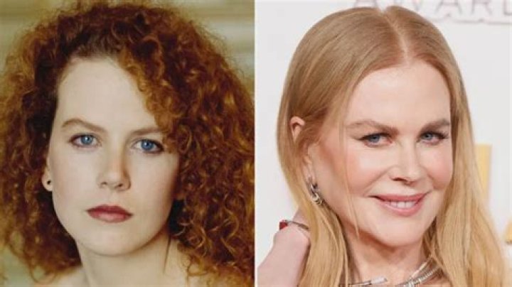 Nicole Kidman Plastic Surgery: Unveiling The Truth Behind The Speculations