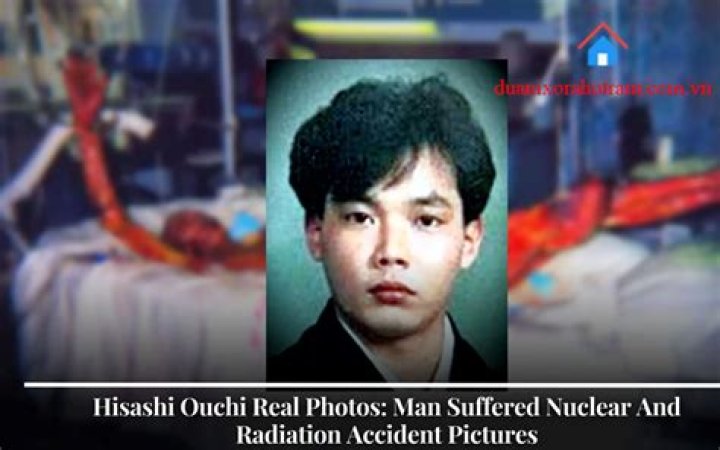 Revealed: The Unseen Real Photos Of Hisashi Ouchi