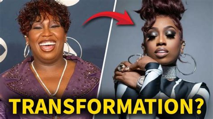 Stunning Transformation: Paris Hilton's Remarkable Nose Job Journey