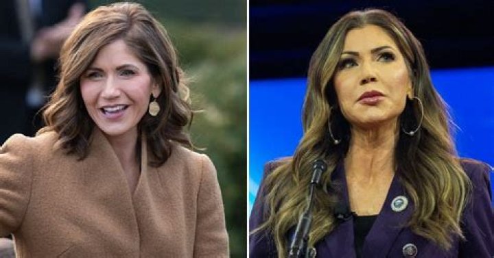 The Secrets And Surprises Of Kristi Noem's Plastic Surgery