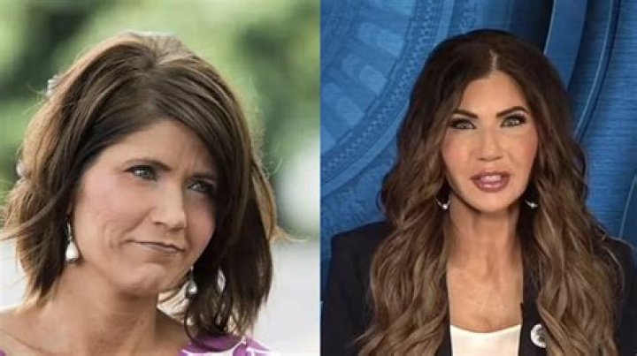 The Ultimate Guide To Kristi Noem's Plastic Surgery Allegations