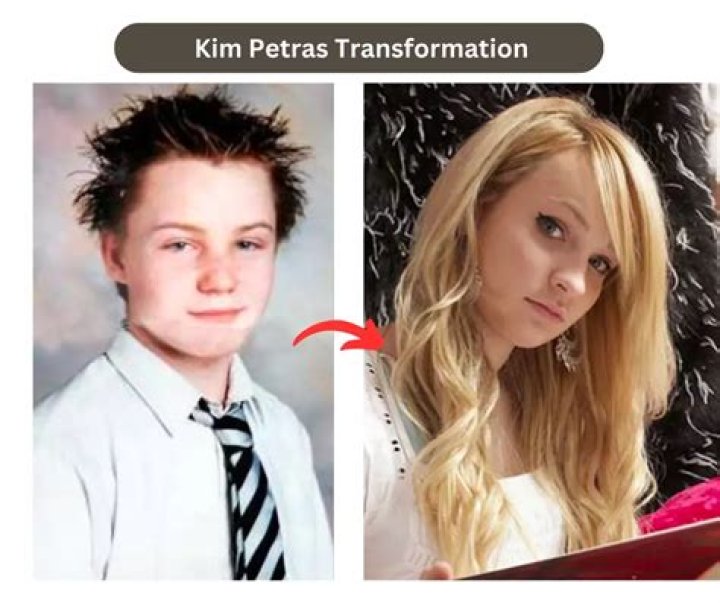 Uncovering The Truth: Kim Petras' Gender Transition Journey