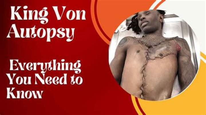 Unseen King Von Autopsy Photos Revealed: A Gruesome Examination