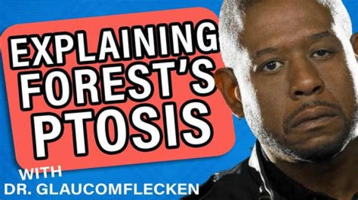 Unveiling The Enigma Of Forest Whitaker's Eye: Discoveries And Insights