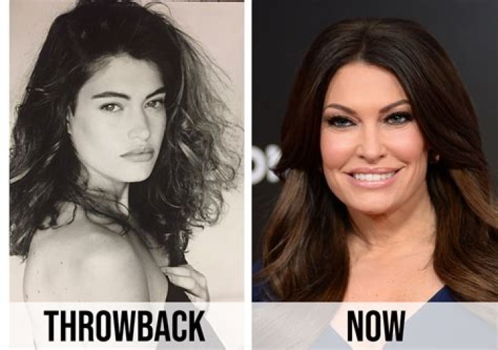 Unveiling The Transformation: Kimberly Guilfoyle's Before And After Journey