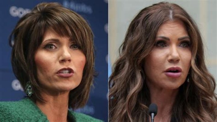 Unveiling The Truth Behind Kristi Noem's Plastic Surgery