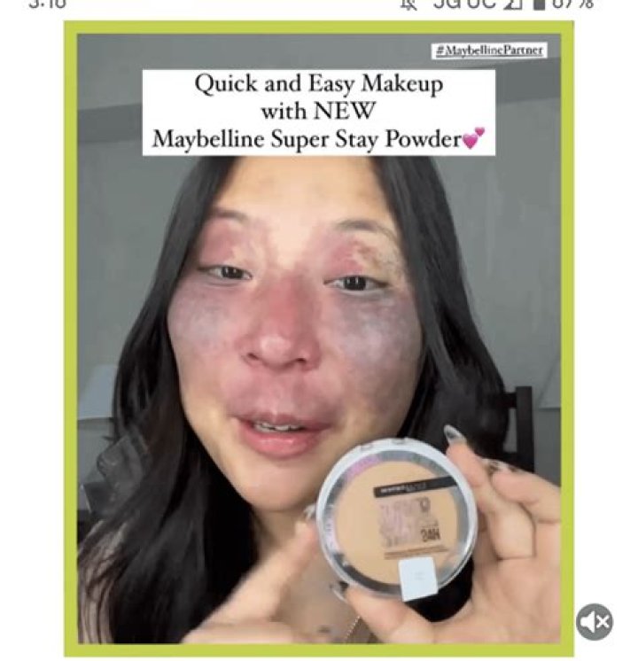 What Is Wrong With Her Face