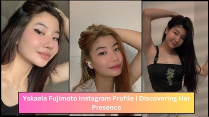 Yskaela Fujimoto Before Surgery: Her Face Viral video